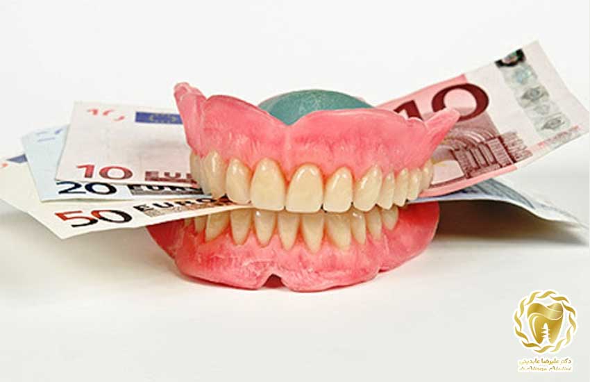 ایمپلنت دندان قسطی