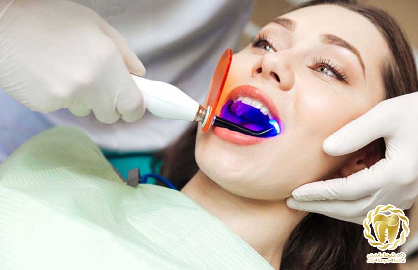 کاربرد لیزر دندانپزشکی
